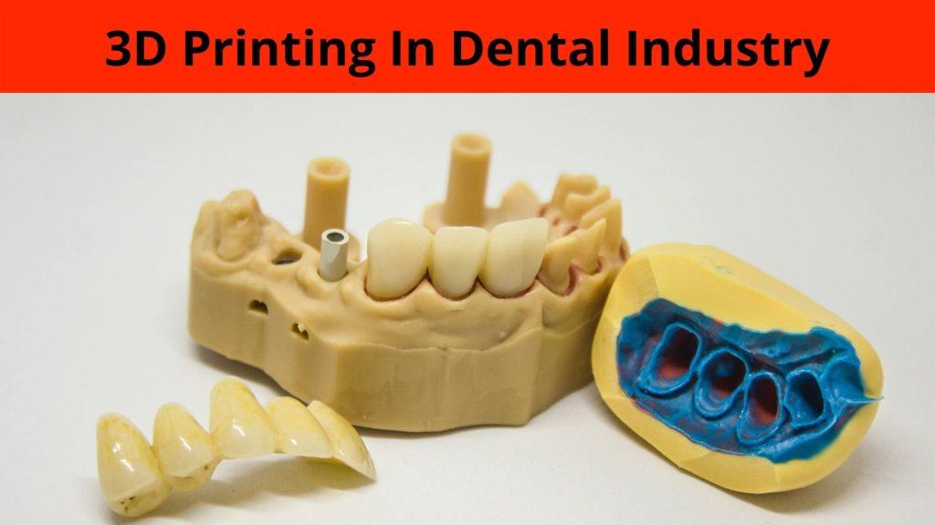 3D Printing in dental Industry